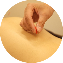 痛くない施術だからストレスなく継続できる